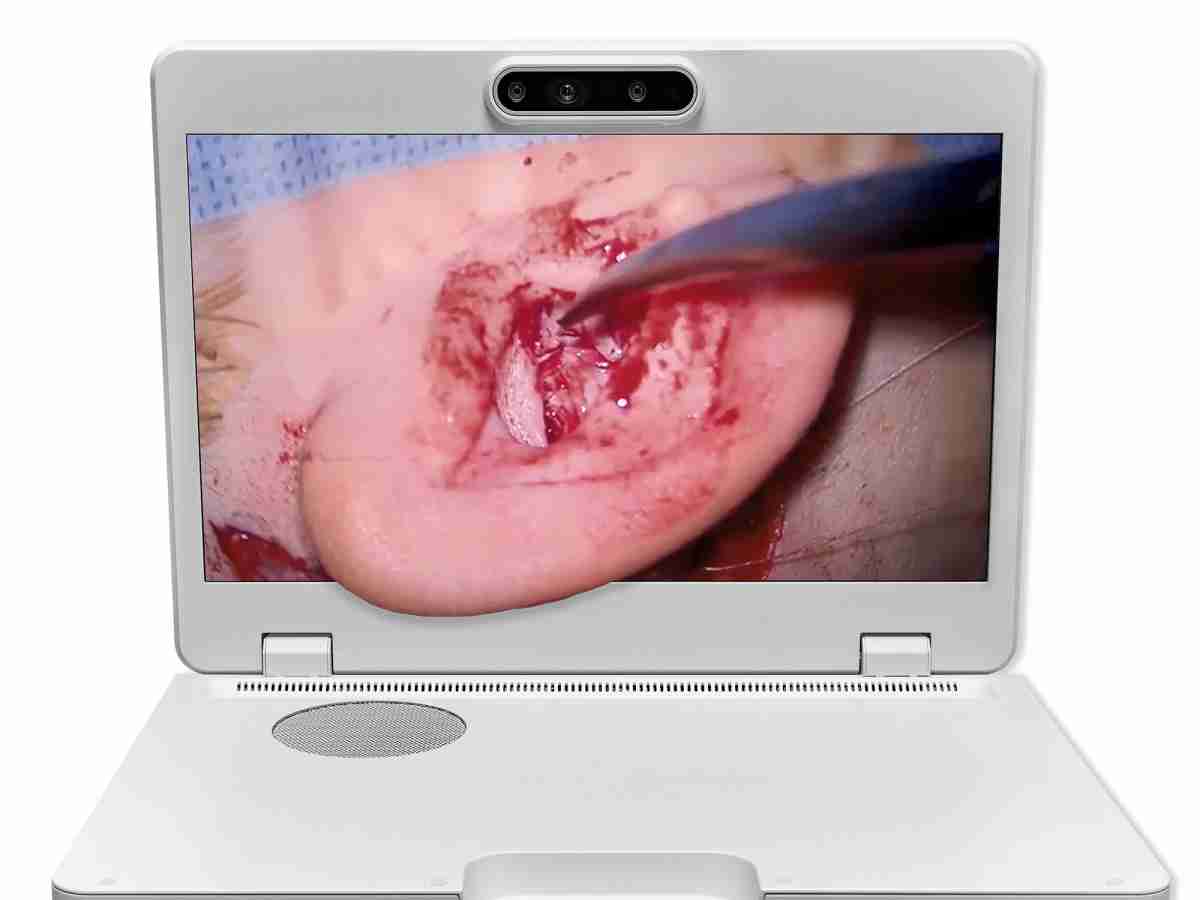 达擎之＂Heads-up 3D显微手术显示系统＂，，，整合4K裸眼3D显示及眼球追踪系统，，，，具备快速追踪人眼移动位置功能，，，，减轻医师长时间维持固定姿势的负担，，，，让医师能有更宽广清晰的3D立体视野及更舒适的姿势来执行手术。。。。